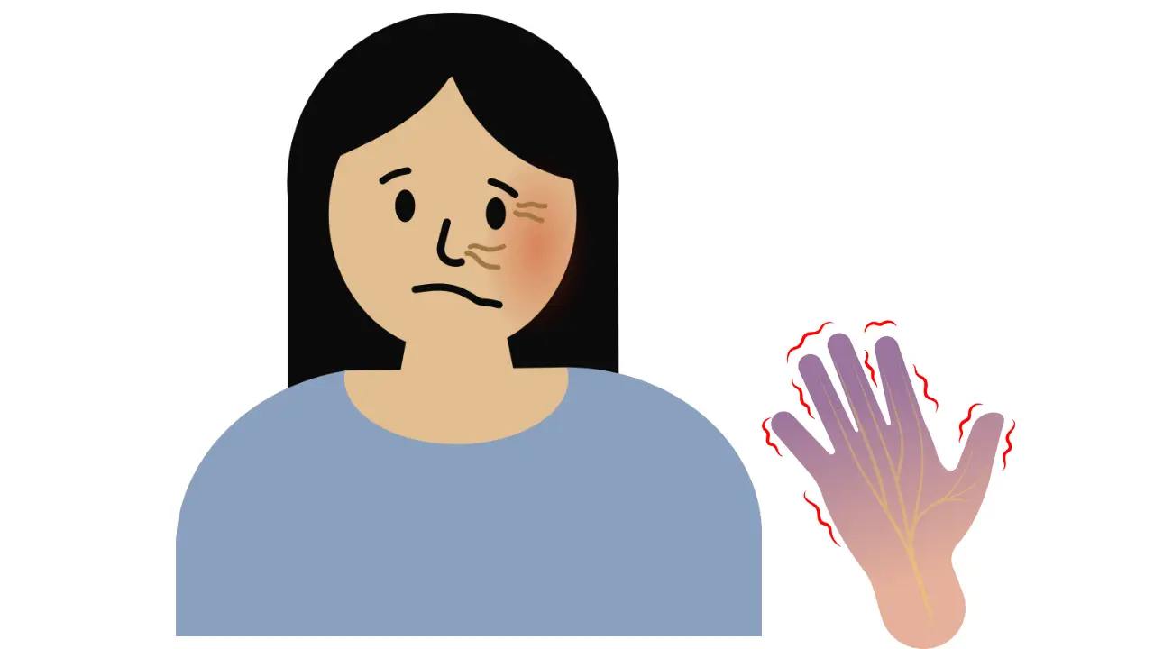 Bell's Palsy | لقوہ