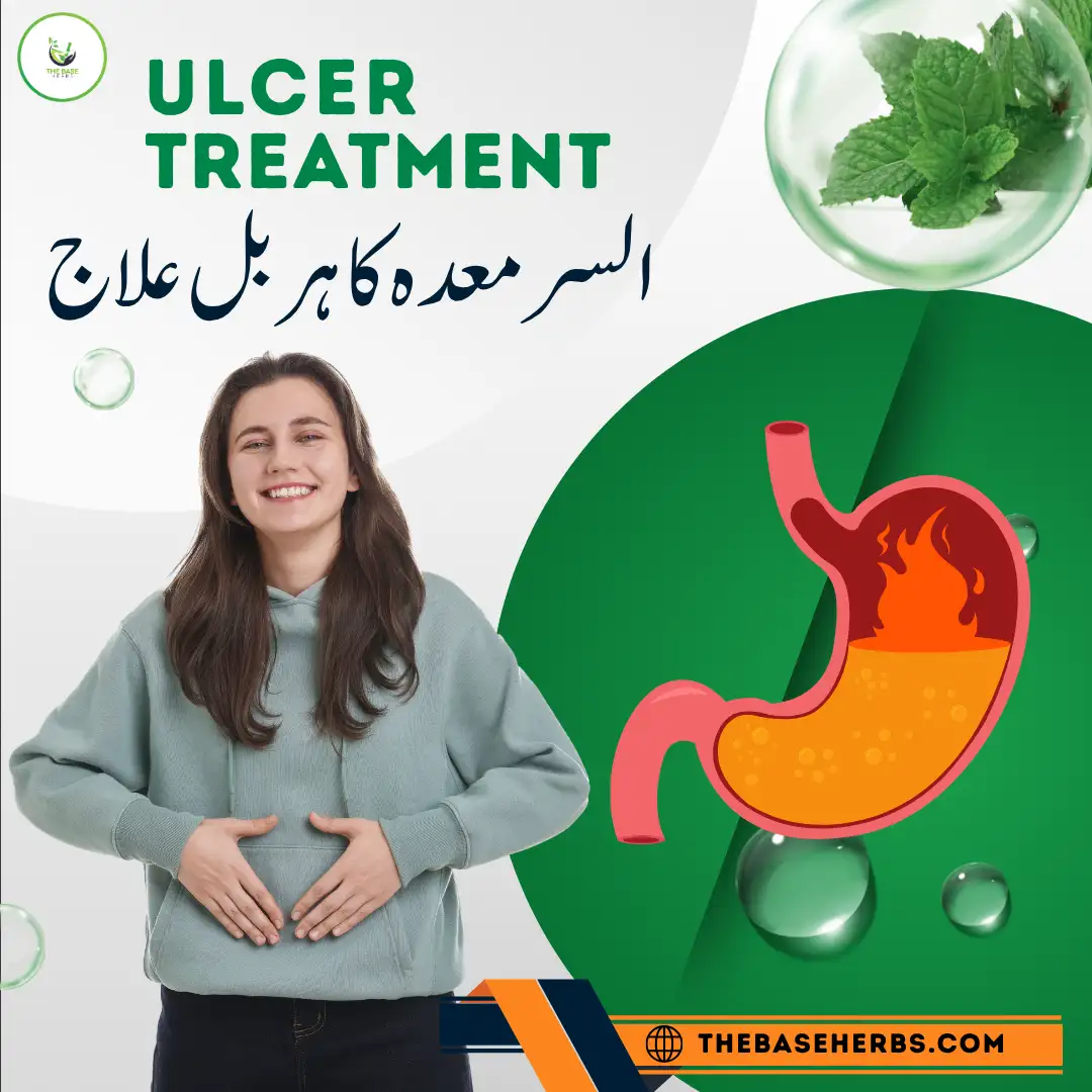 معدے کے السر کا شافی ہربل قدرتی علاج