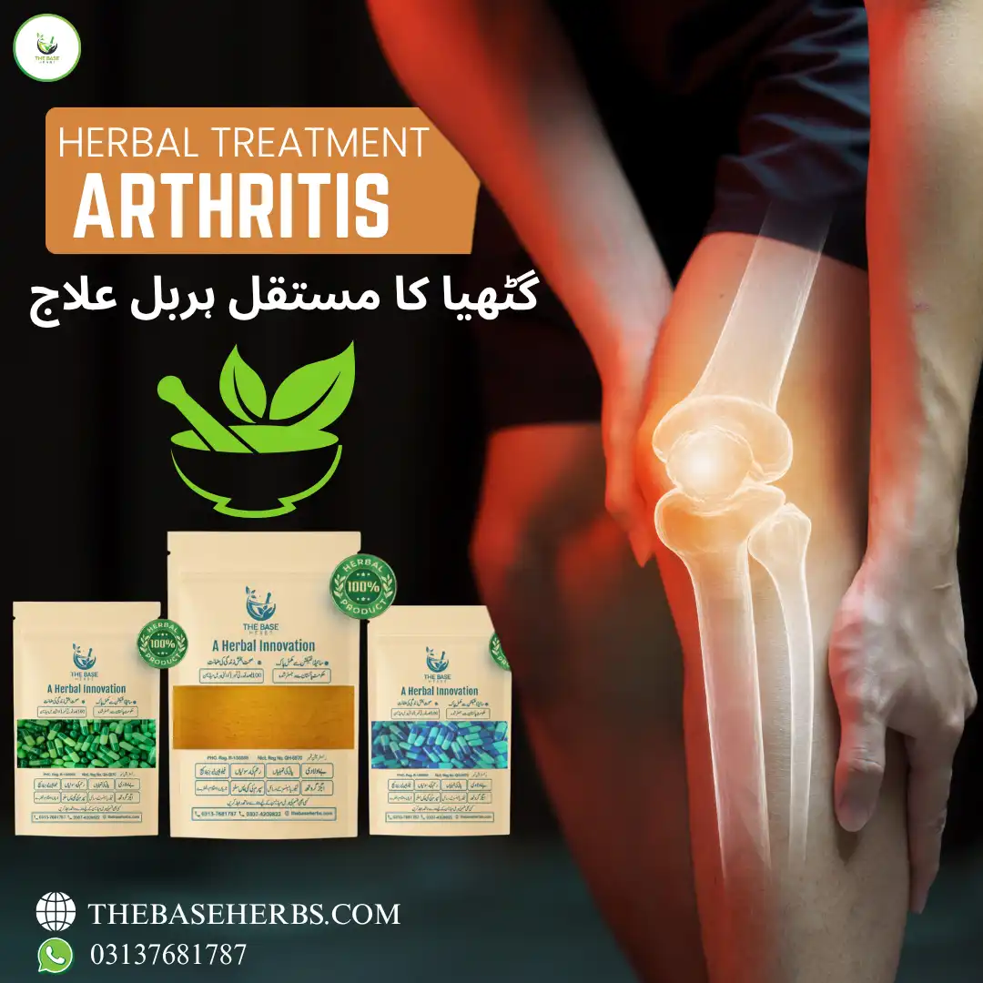 گٹھیا (آرتھرائٹس)  کا ہربل علاج