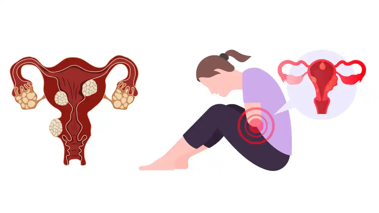 <p class="ql-align-right" dir="rtl"><br></p><p class="ql-align-right" dir="rtl">رحم کی رسولی کا مجرب یونانی علاج</p><p>Uterine Fibroid Herbal Remedy — TheBaseHerbs.com</p>