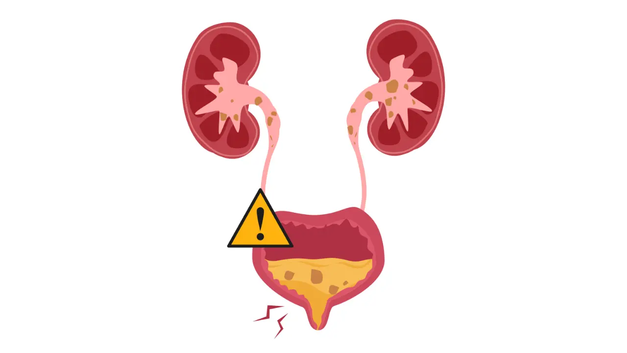 Urinary Disorder | یورن کے مسائل